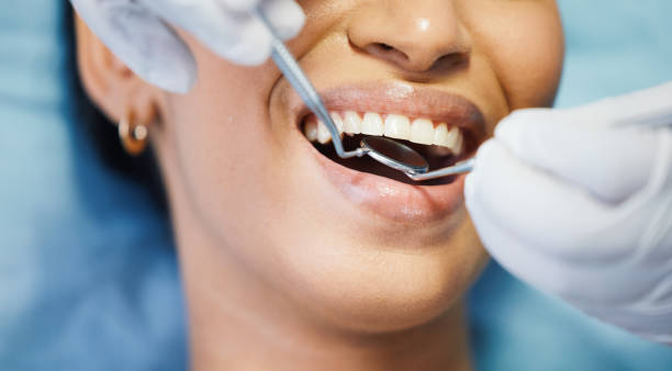 Best Emergency Dental Care for Broken or Chipped Teeth in Kings Beach, CA
