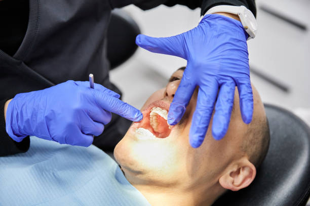 Best Emergency Treatment for Dental Infections or Abscesses in Kings Beach, CA